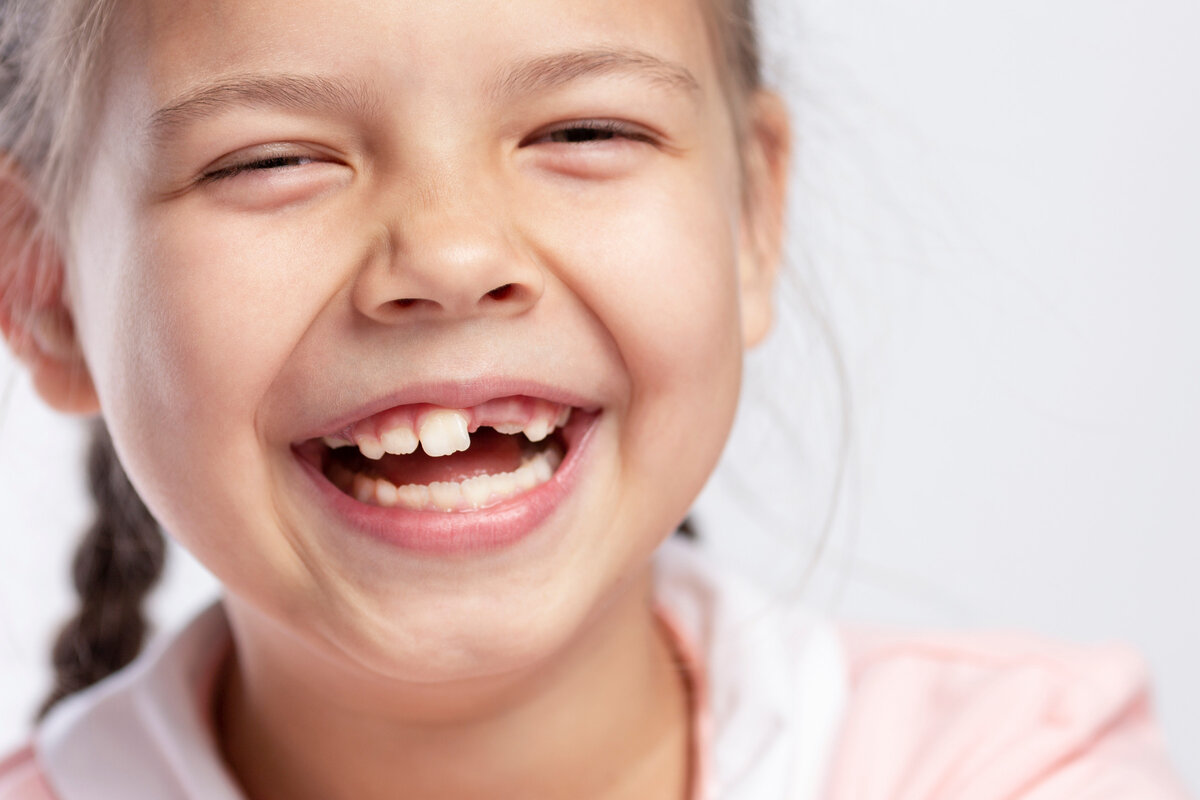 Красивые белые зубы у детей